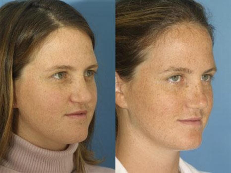 Images Gotham Plastic Surgery