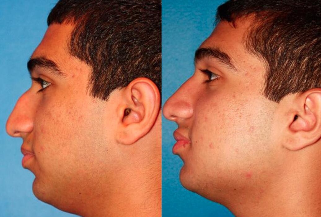 Images Gotham Plastic Surgery