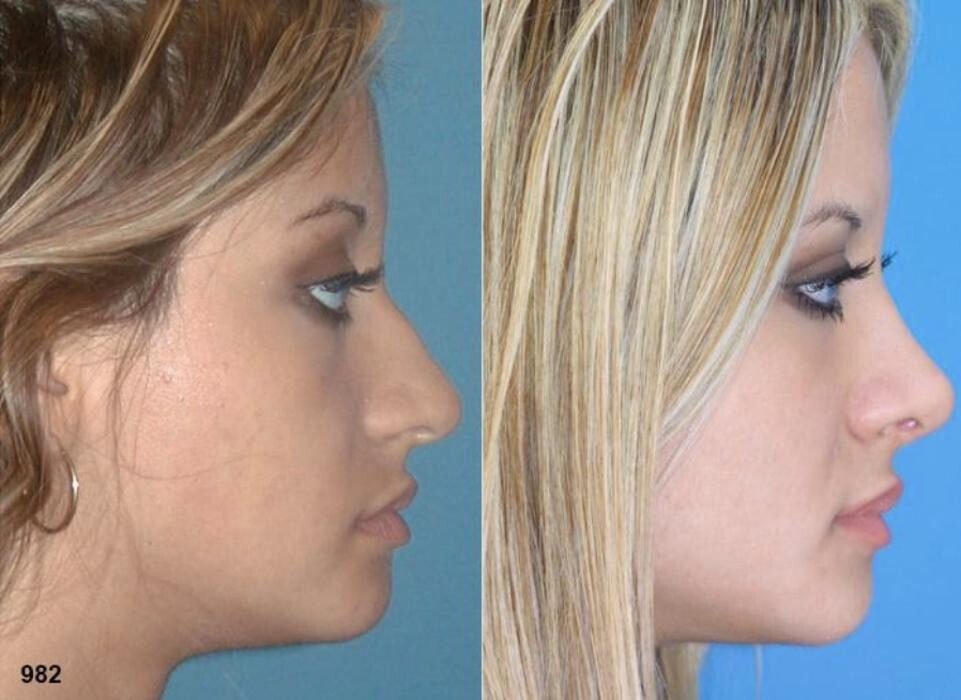 Images Gotham Plastic Surgery