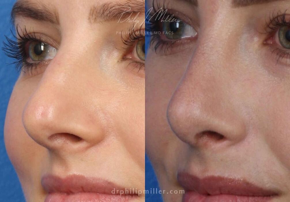 Images Gotham Plastic Surgery