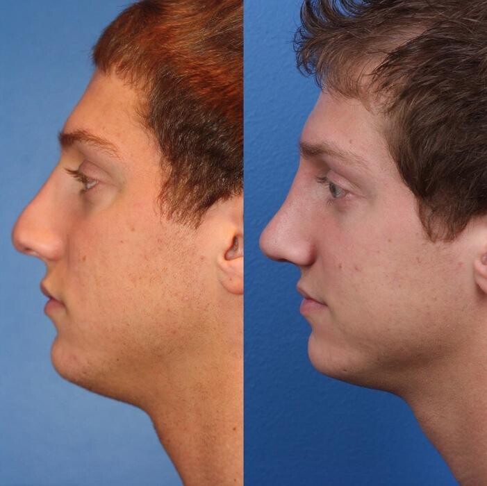 Images Gotham Plastic Surgery