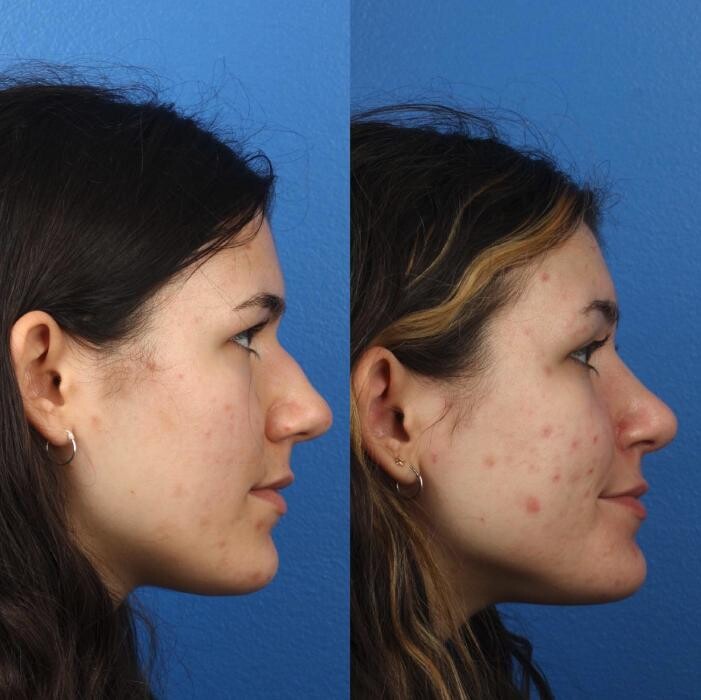 Images Gotham Plastic Surgery