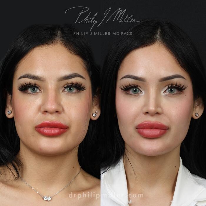 Images Gotham Plastic Surgery