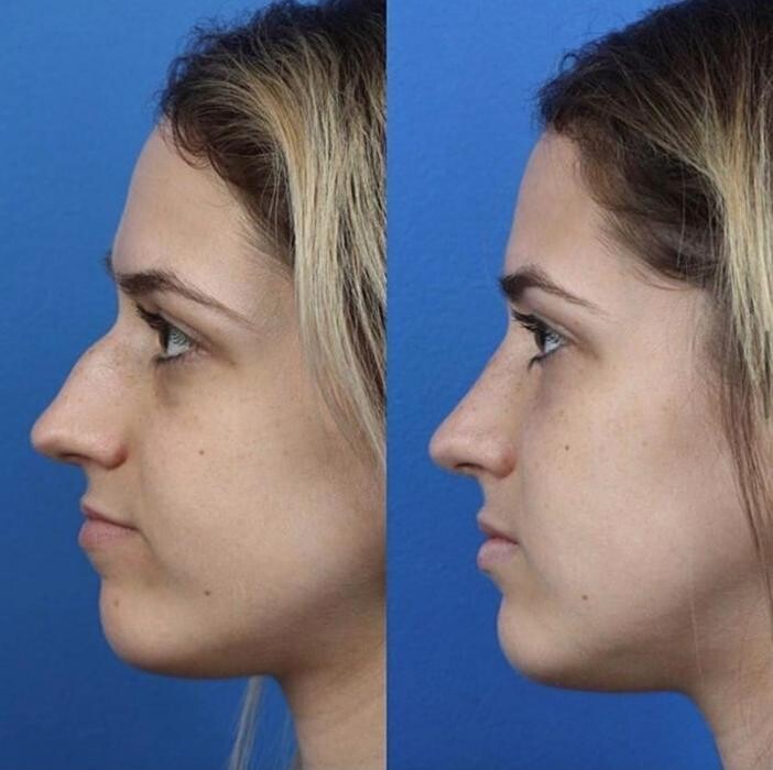 Images Gotham Plastic Surgery