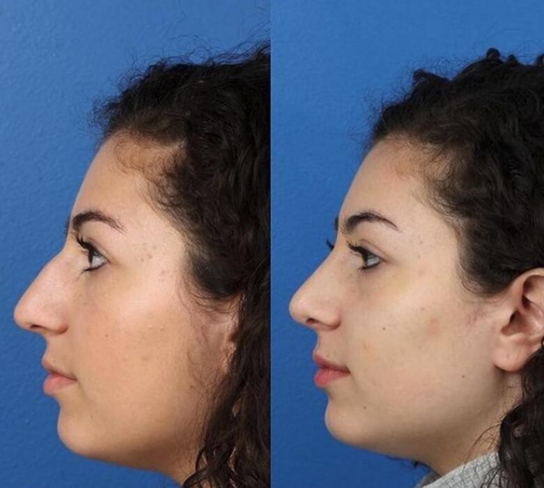 Images Gotham Plastic Surgery