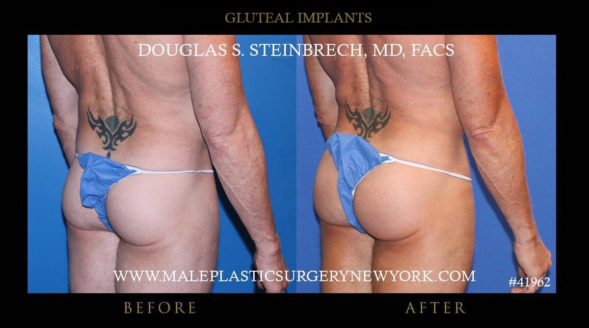 Images Gotham Plastic Surgery