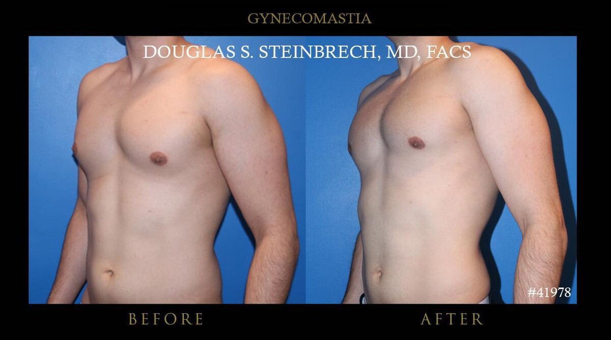 Images Gotham Plastic Surgery