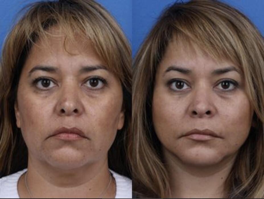 Images Gotham Plastic Surgery