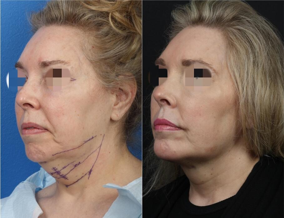Images Gotham Plastic Surgery