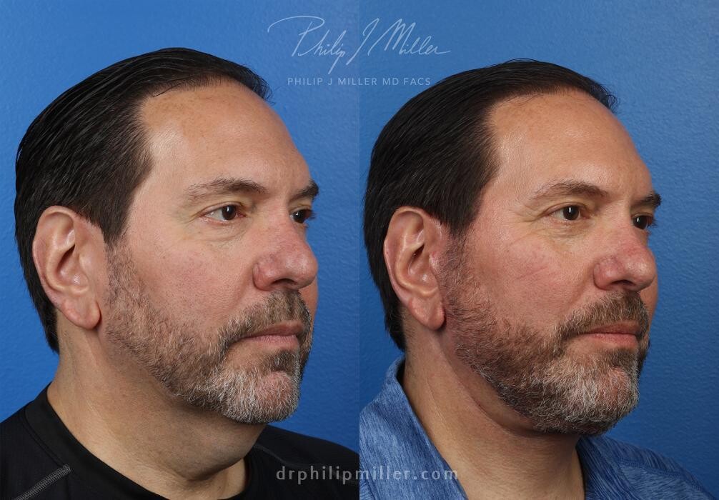 Images Gotham Plastic Surgery