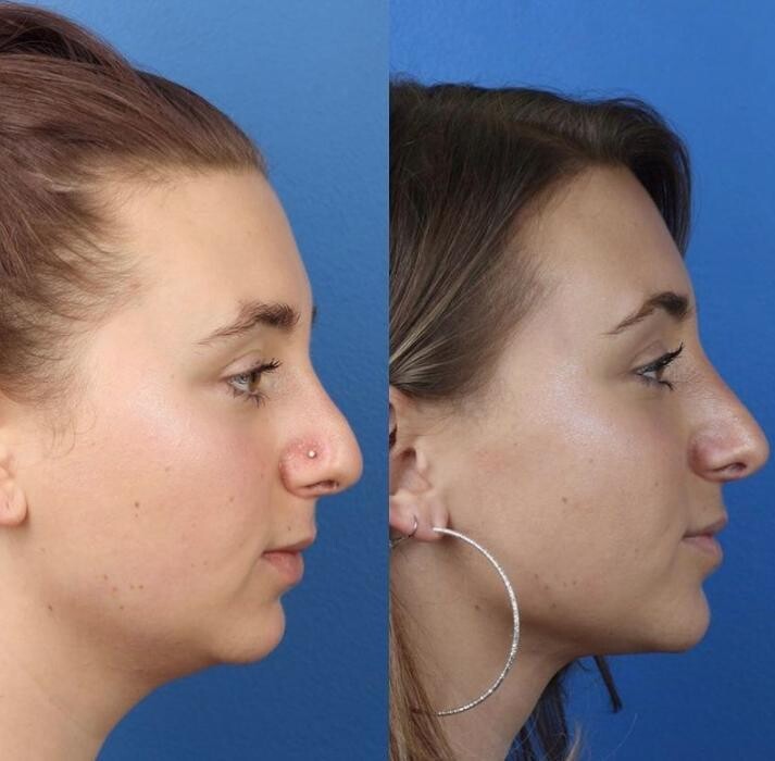 Images Gotham Plastic Surgery