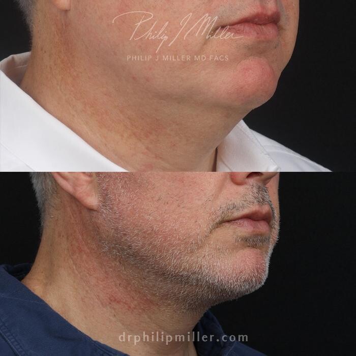 Images Gotham Plastic Surgery