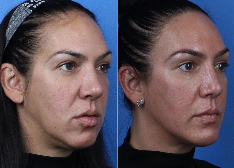 Images Gotham Plastic Surgery