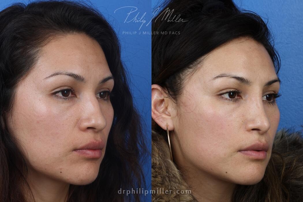 Images Gotham Plastic Surgery