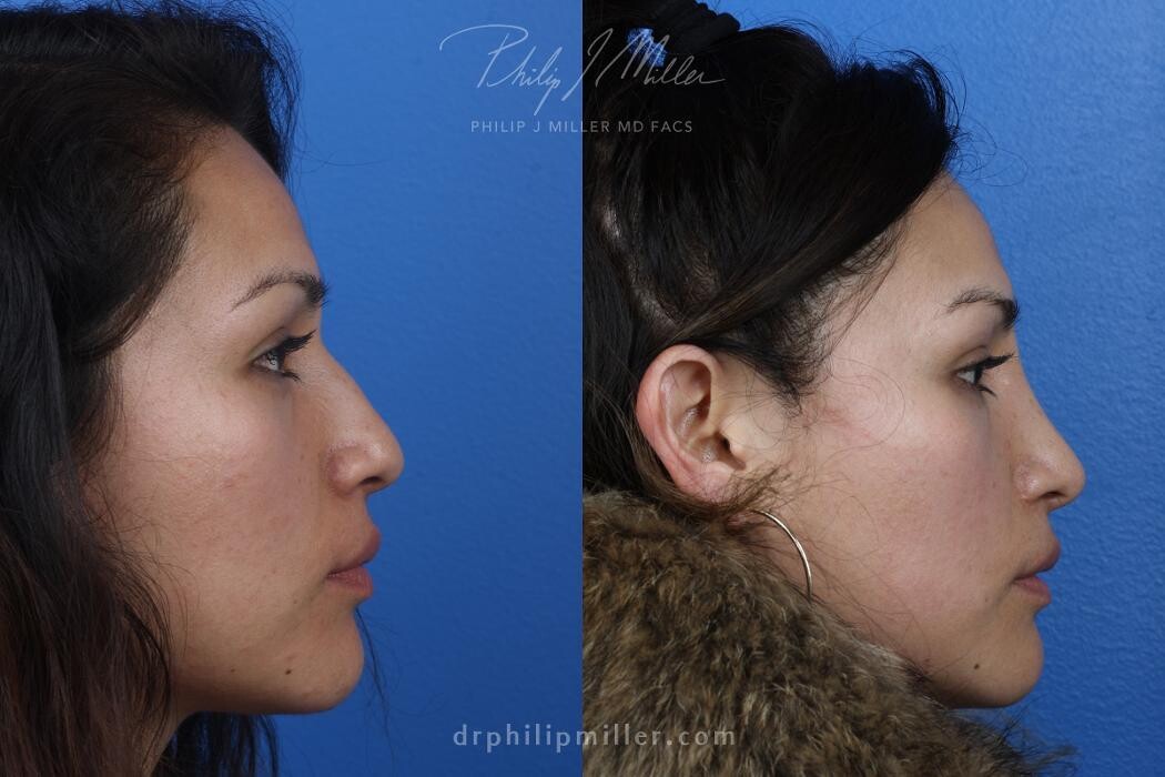 Images Gotham Plastic Surgery