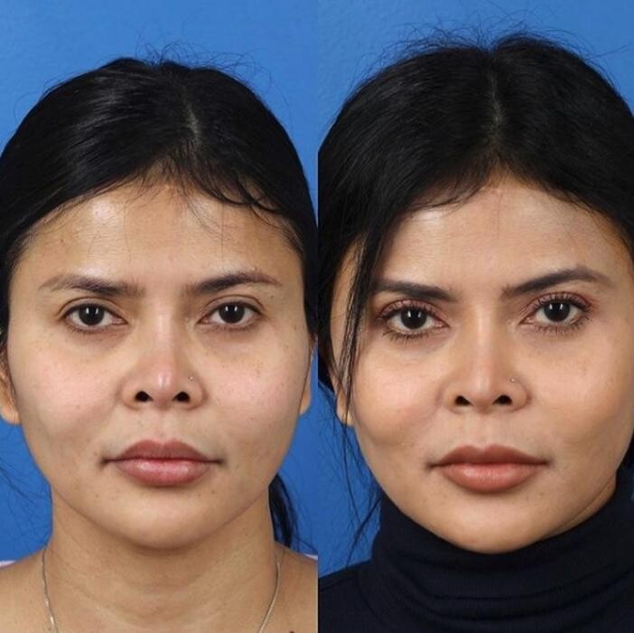 Images Gotham Plastic Surgery