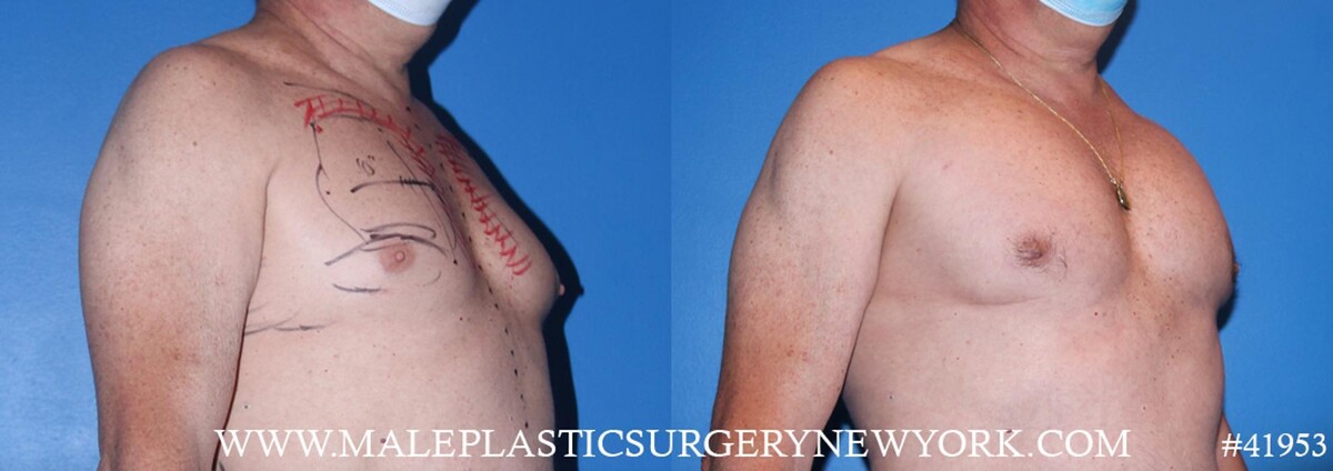 Images Gotham Plastic Surgery