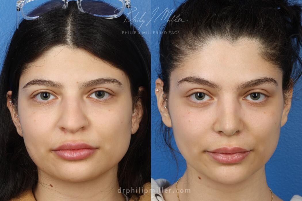 Images Gotham Plastic Surgery