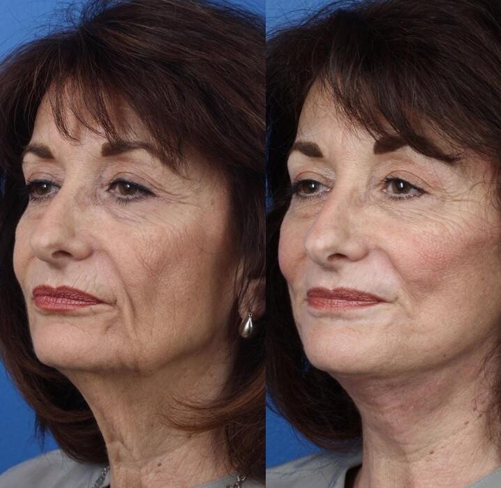 Images Gotham Plastic Surgery