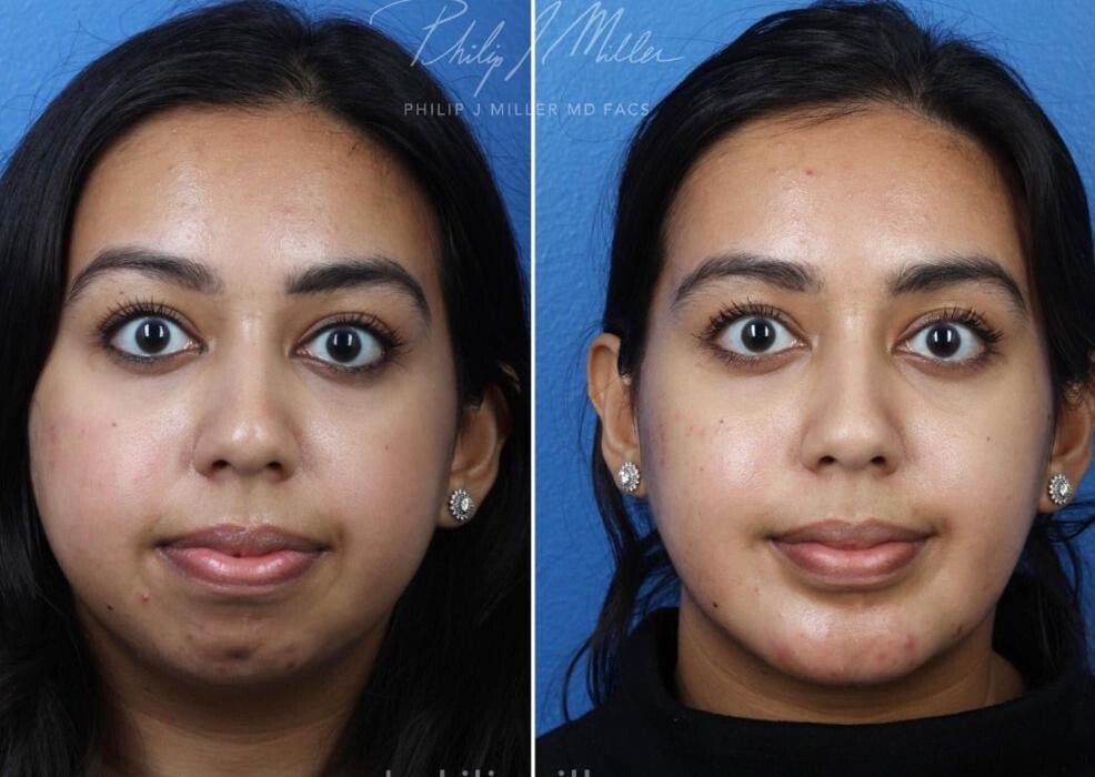 Images Gotham Plastic Surgery