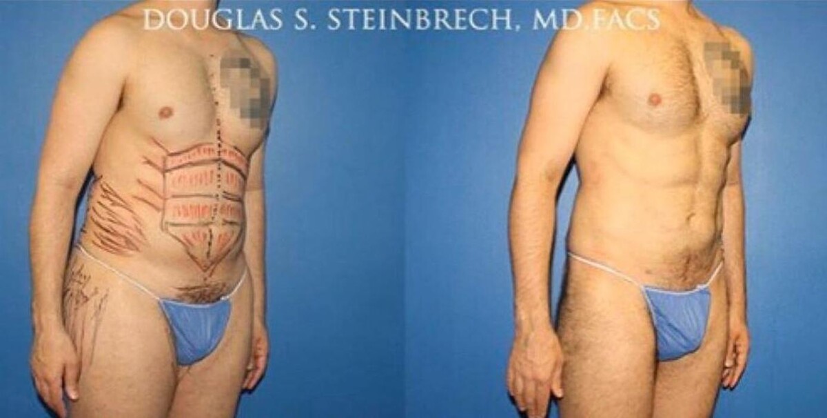 Images Gotham Plastic Surgery