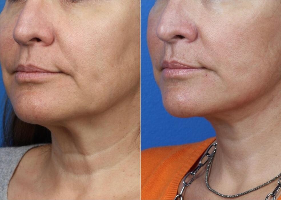 Images Gotham Plastic Surgery