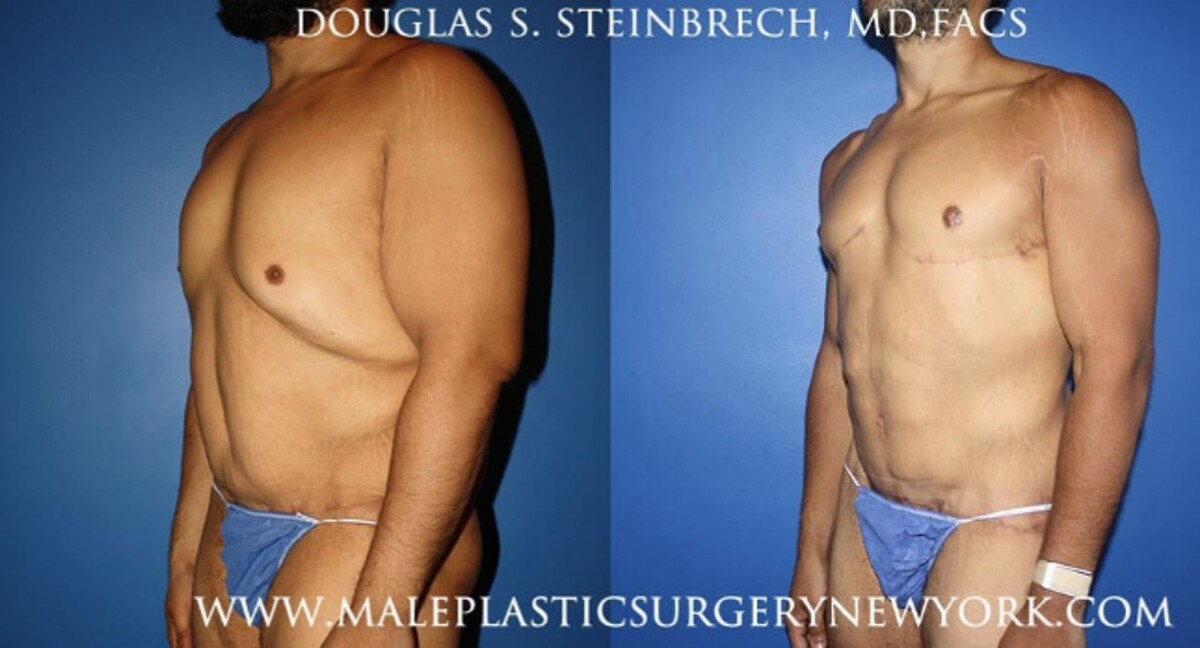 Images Gotham Plastic Surgery