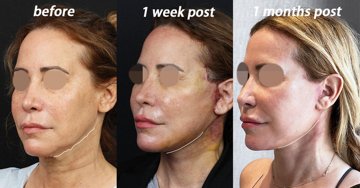 Images Gotham Plastic Surgery