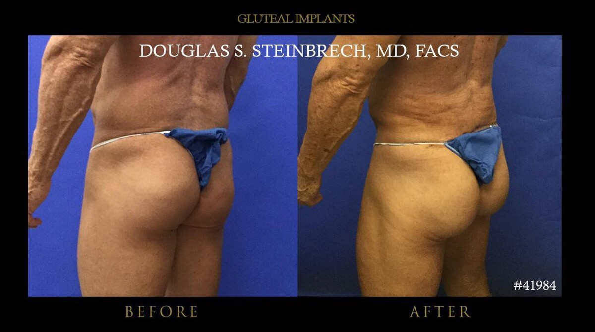 Images Gotham Plastic Surgery