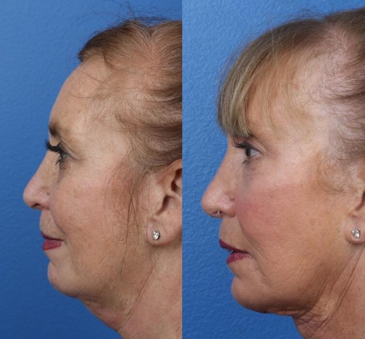 Images Gotham Plastic Surgery