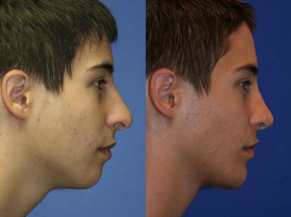 Images Gotham Plastic Surgery