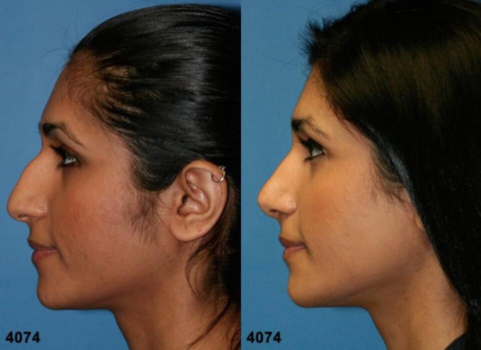 Images Gotham Plastic Surgery