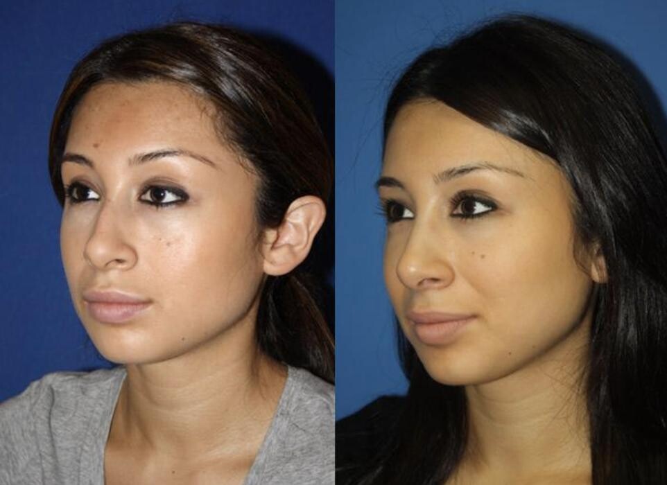 Images Gotham Plastic Surgery