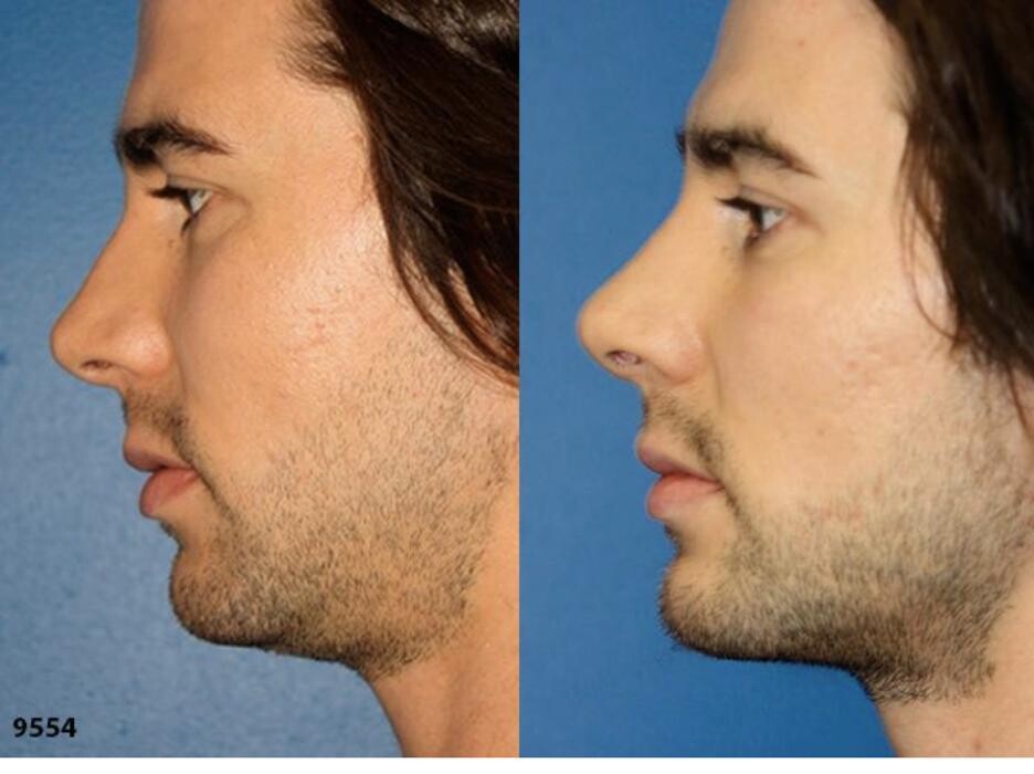 Images Gotham Plastic Surgery