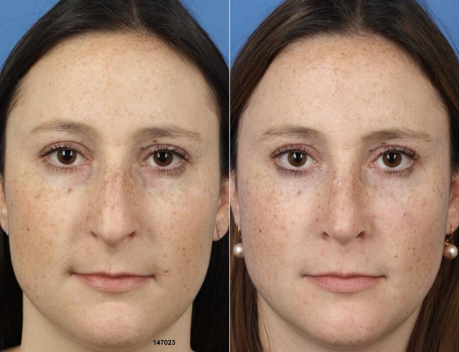 Images Gotham Plastic Surgery