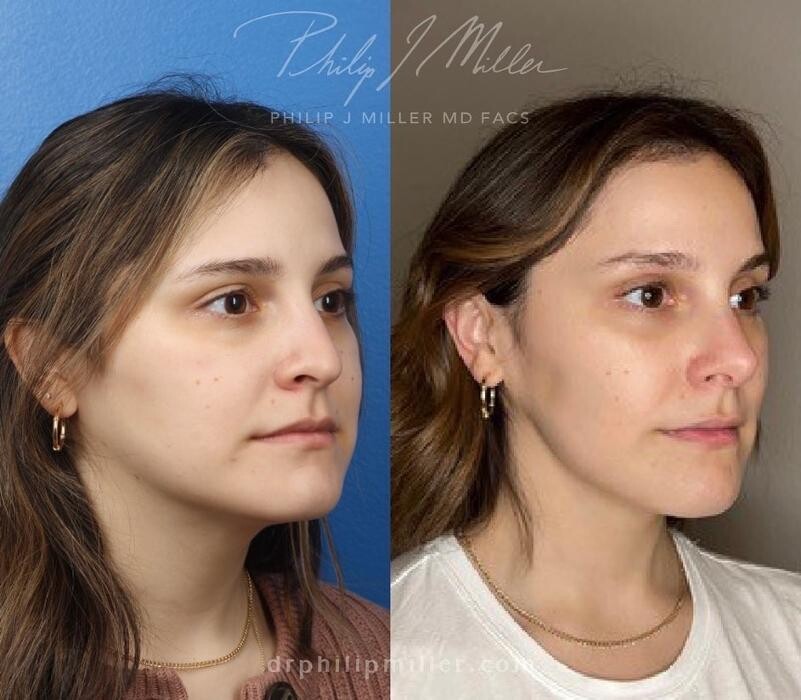 Images Gotham Plastic Surgery