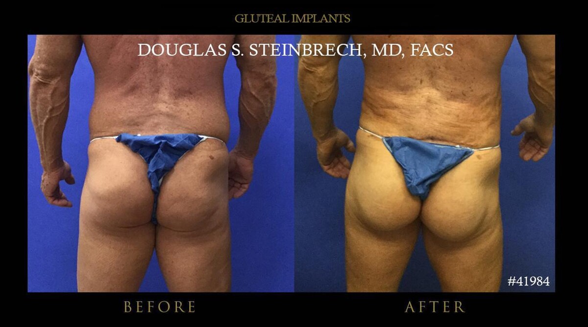 Images Gotham Plastic Surgery