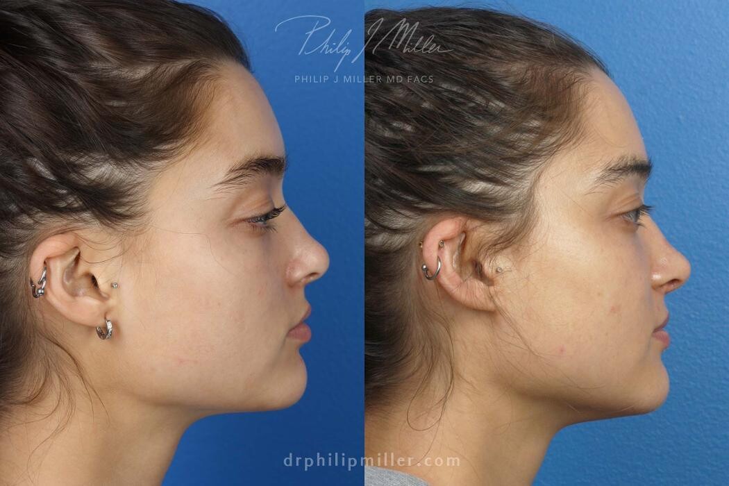 Images Gotham Plastic Surgery
