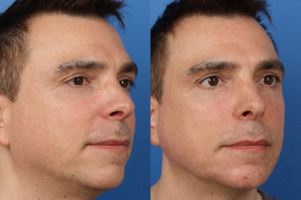 Images Gotham Plastic Surgery