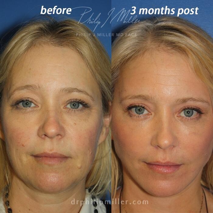 Images Gotham Plastic Surgery