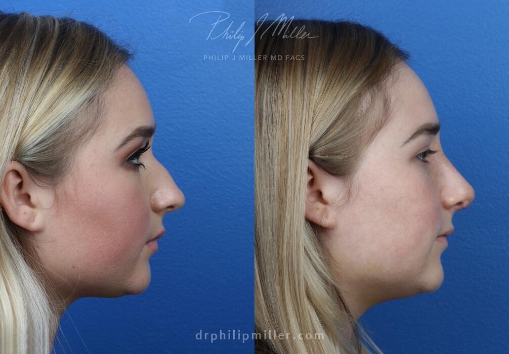 Images Gotham Plastic Surgery