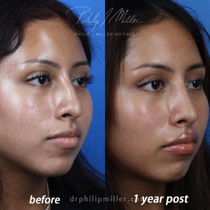 Images Gotham Plastic Surgery