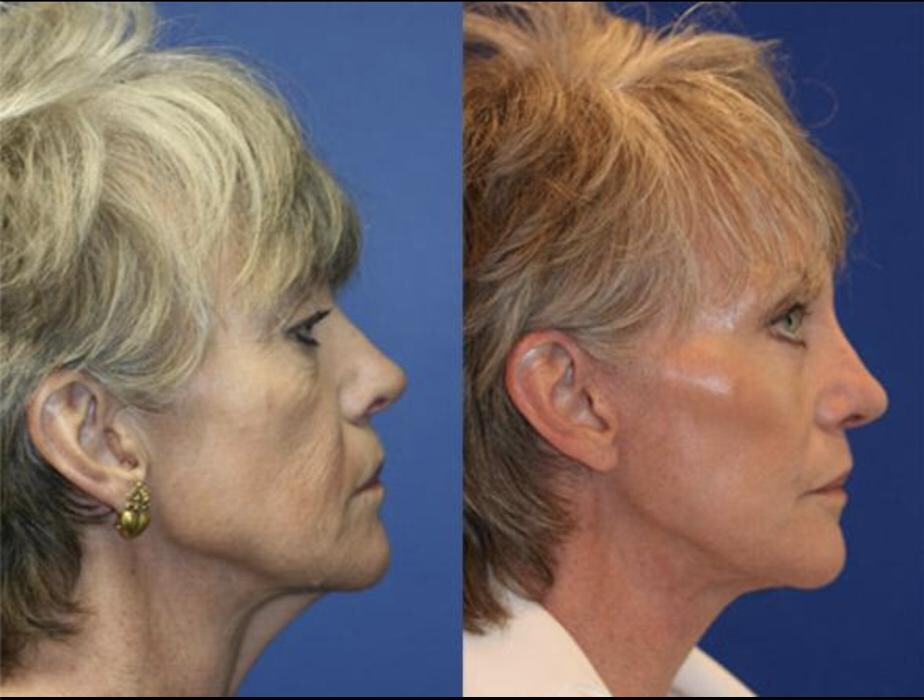 Images Gotham Plastic Surgery