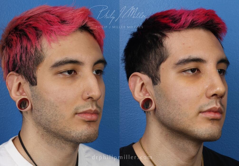 Images Gotham Plastic Surgery