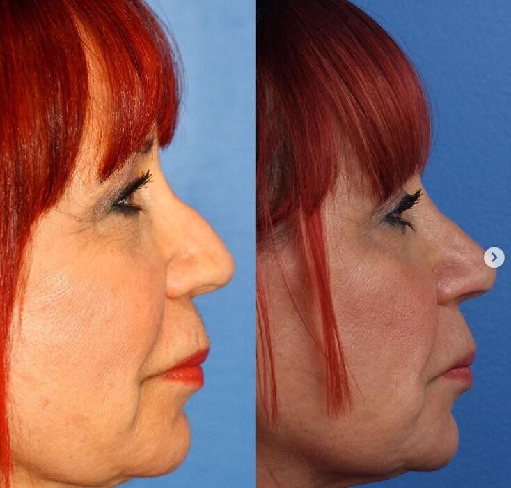 Images Gotham Plastic Surgery