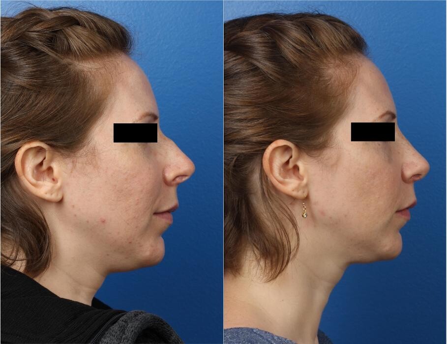 Images Gotham Plastic Surgery