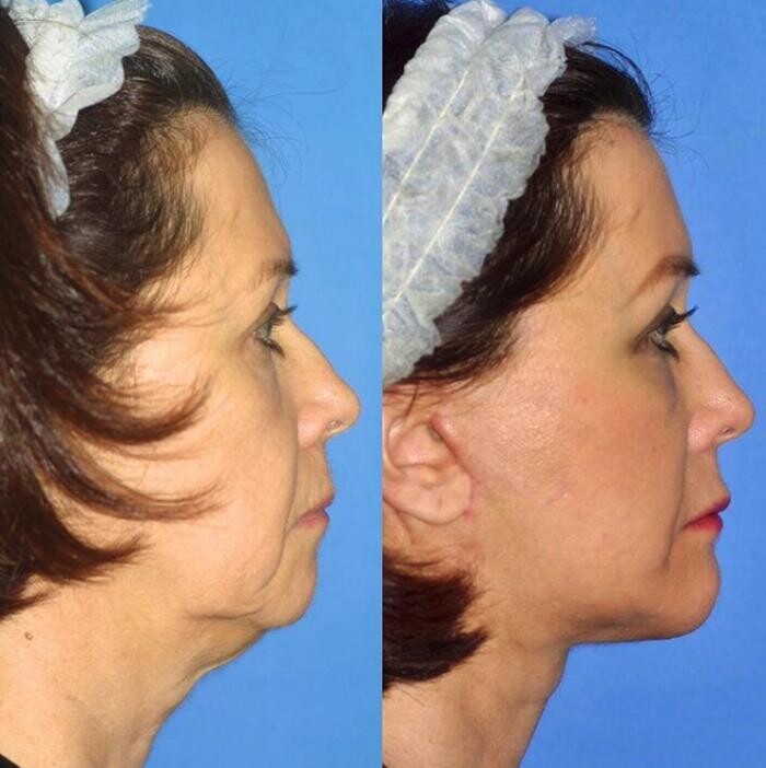 Images Gotham Plastic Surgery