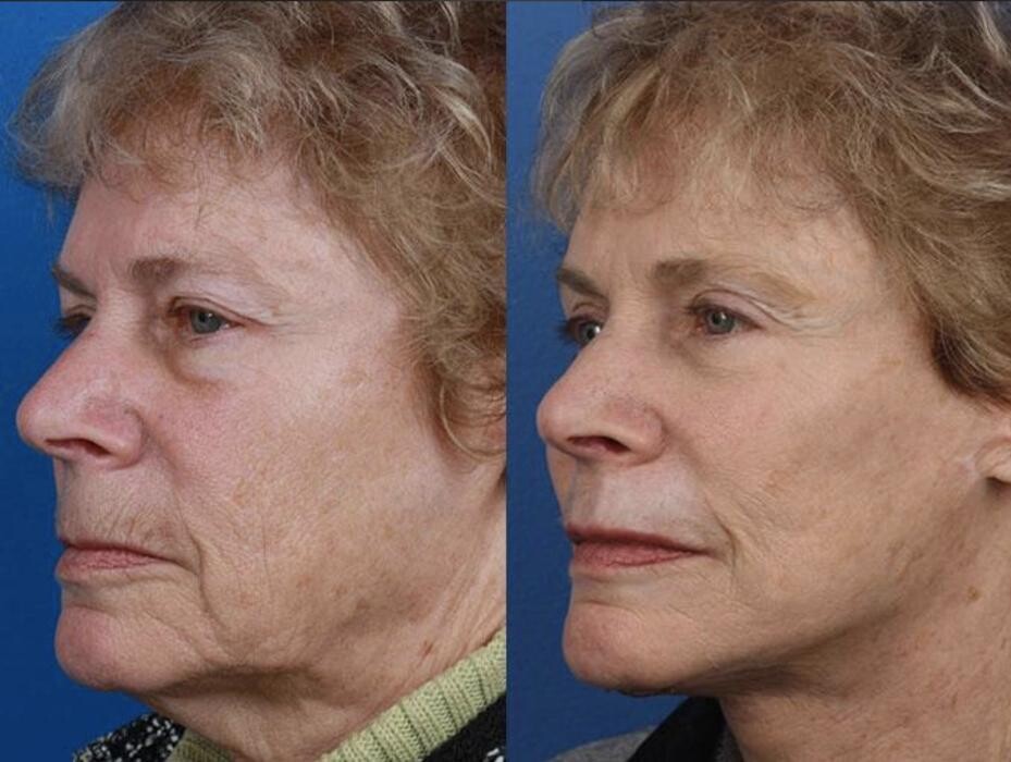 Images Gotham Plastic Surgery