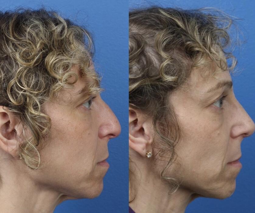 Images Gotham Plastic Surgery