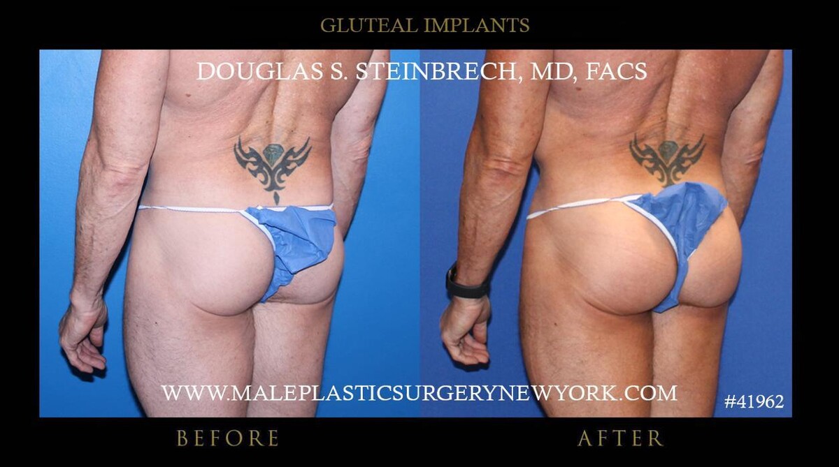 Images Gotham Plastic Surgery